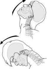 Head Extension and Flexion