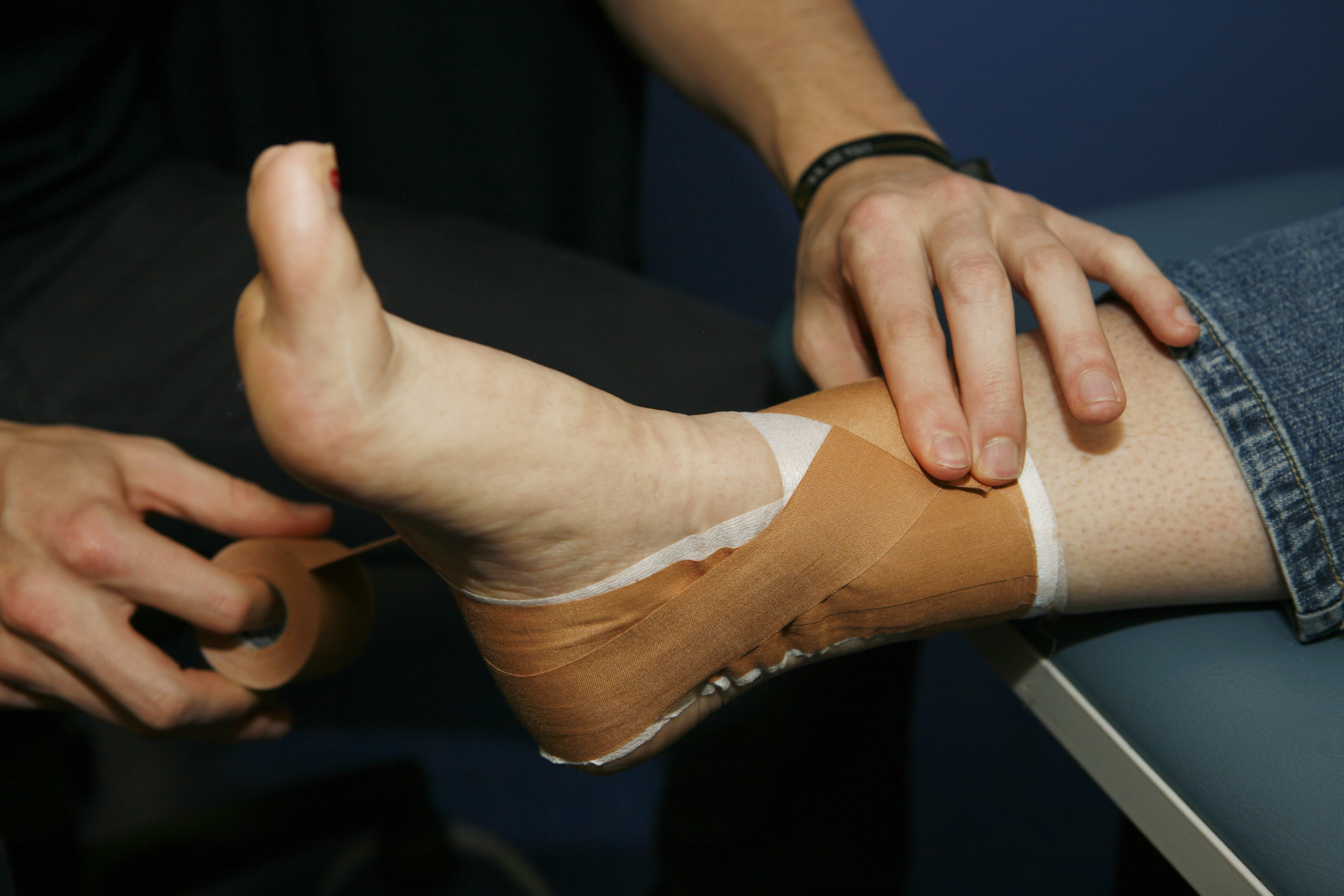 It's Just A Sprain” – The Importance Of Physio For Ankle Sprains